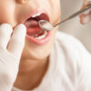 Προληπτικός οδοντιατρικός έλεγχος παιδιών